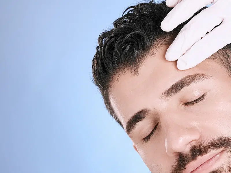 costo-de-la-cirugia-de-restauracion-del-cabello-capilar-hair-center-tijuana